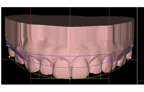Digital Smile Design